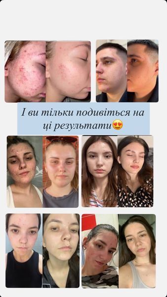 Бовтанка 100 ml. 0001 фото